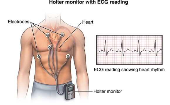 Electrocardiogram (ECG) / Holter / Event Monitor