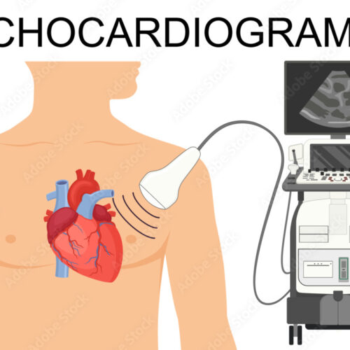 Echocardiogram