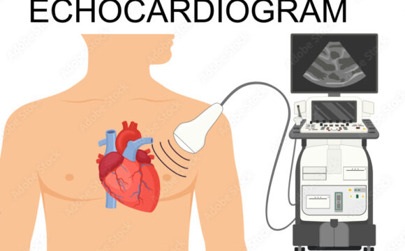 Echocardiogram