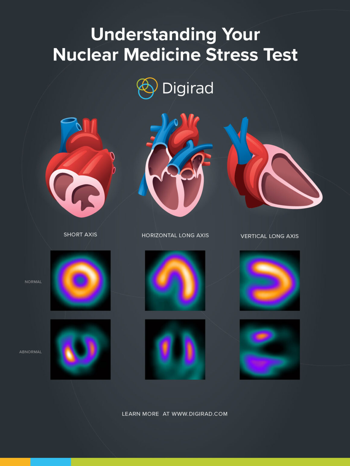 Nuclear Stress Tests