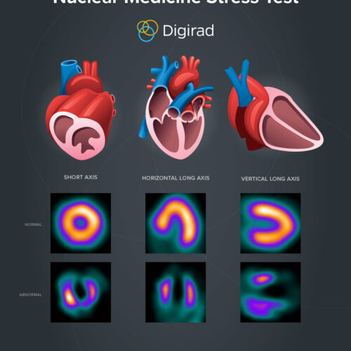 Nuclear Stress Tests